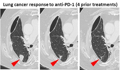 2012-anti-PD-1-lung-cancer-response.jpg